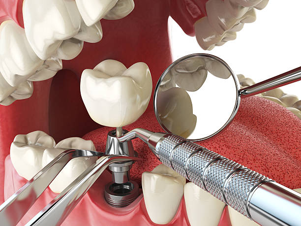 Best Emergency Treatment for Jaw Pain or Injury in Camano, WA
